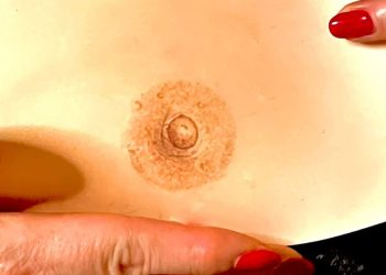 Alessandra Centrone, l’artista che ricostruisce l’areole mammarie alle donne che hanno sofferto